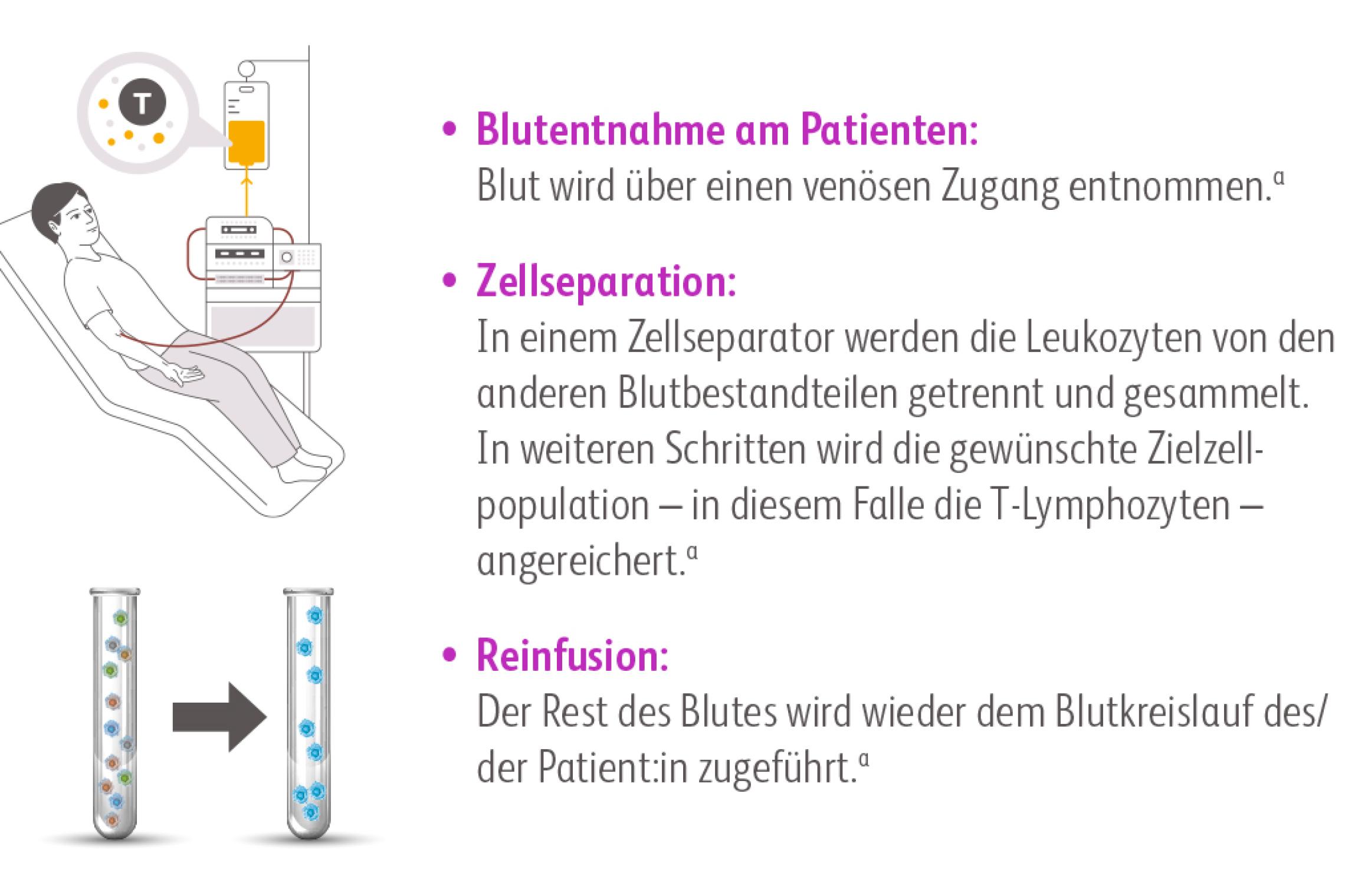 Schaubild der Leukapherese, Blutentnahme am Patienten, Zellseparation der Leukozyten und Rückführung des restlichen Blutes zum Blutkreislauf des Patienten