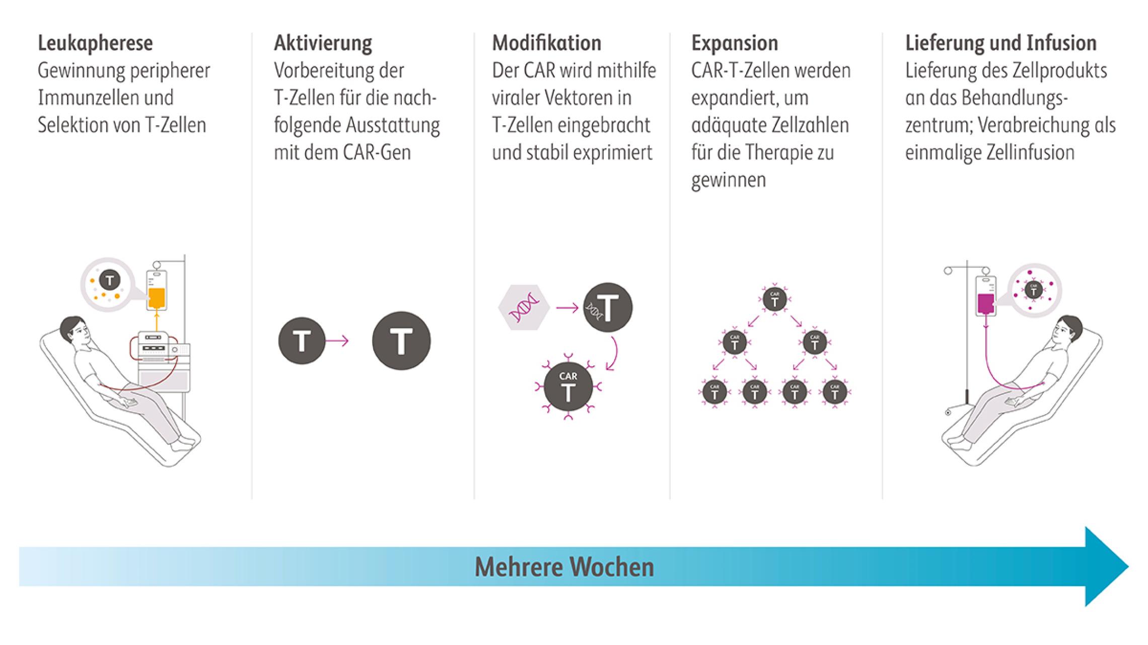 Schaubild Herstellung von CAR-T-Zellen und Ablauf der CAR-T-Zelltherapie