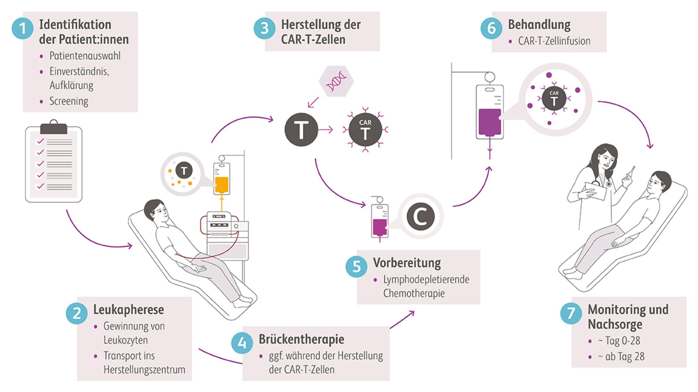 Schaubild über die Kernelemente der CAR-T-Zelltherapie